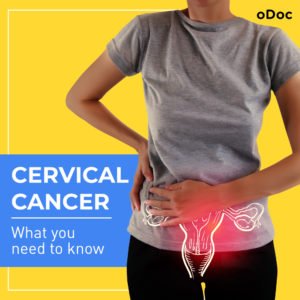 cervical cancer